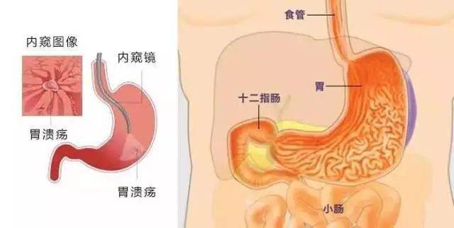 胃镜结构图解图片