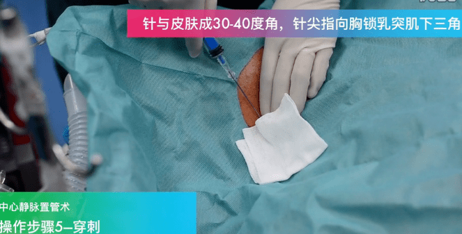 麻醉科医生必看新青年视频中心重大升级