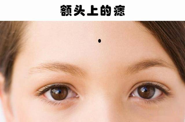 3,额头上的痣鼻子上拥有痣的人通常是一个自尊心较强,而且非常努力的