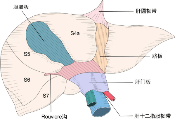 即肝门板,胆囊板,脐板,如图 1:三:三个肝板如何降低该并发症的发生呢