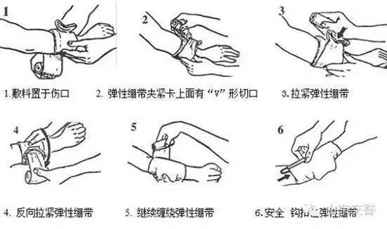 大巴车疾驰中被削顶1死6伤