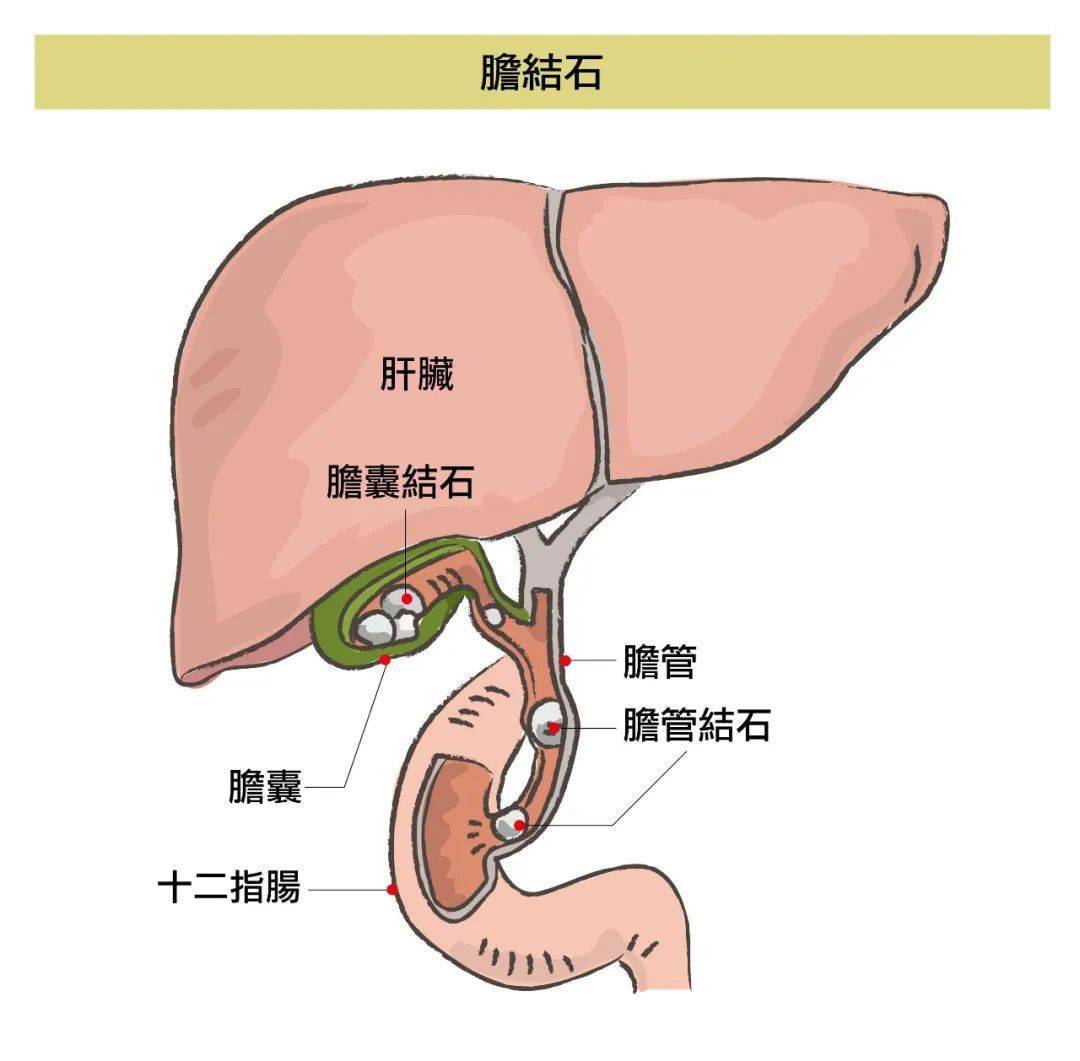 胆囊人体示意图图片