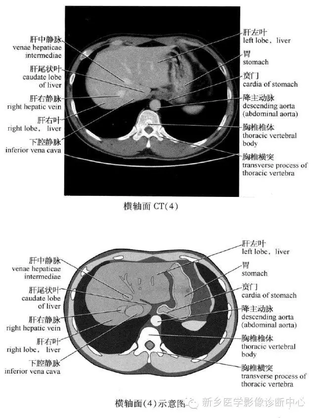 史上最全腹部横断位解剖详细标注