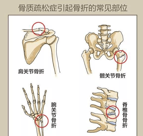 e42cfa178a9948f6bcc0808219a6595d.png