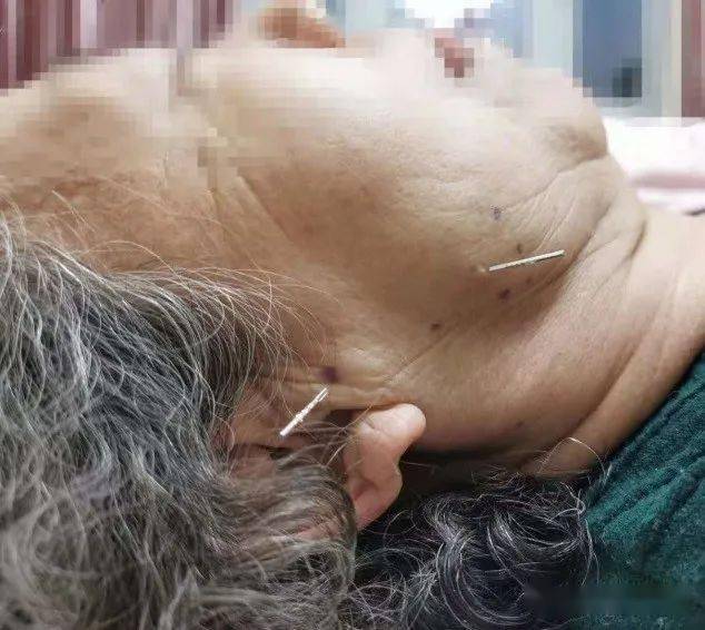 疼痛科怎么理疗拍片子都找不出原因的肩颈腰腿痛，只能忍着吗？_https://www.jmylbn.com_新闻资讯_第2张