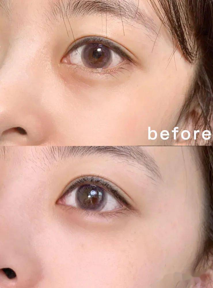 眼下的一些干纹,涂抹按摩吸收,用上一段时间之后, 明显感觉到眼下的