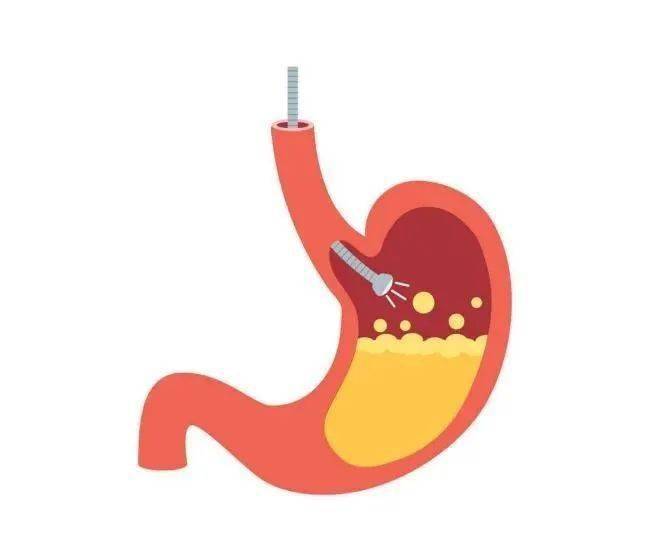不觉得饿,小郑就给小黄买了个冰激凌,刚吃几口,小黄突然胃内一阵翻搅