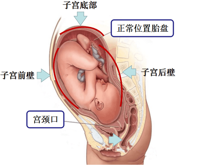 胎盘位置不好?这个数值越小越危险