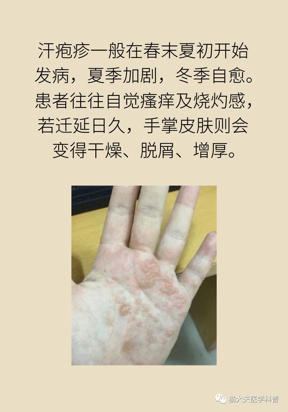 汗皰疹,痱子,狐臭,多汗…… 排汗有障礙怎麼破?