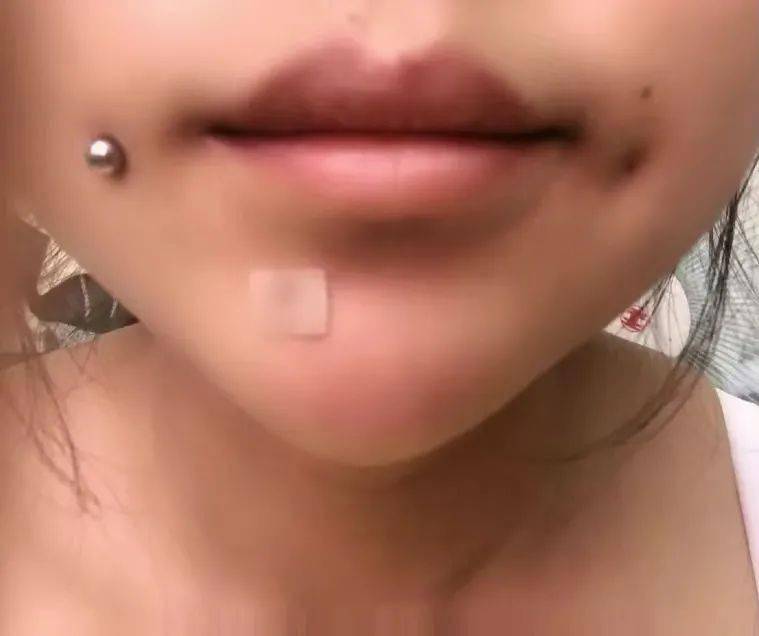 梨涡对面部优化效果竟然那么大