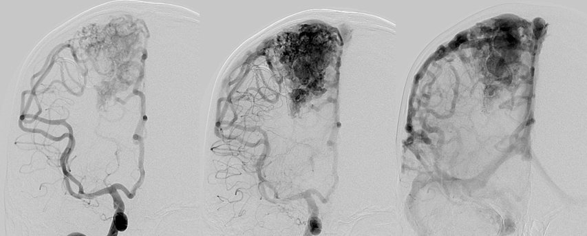 邓剑平教授专栏丨我和我的畸形故事九