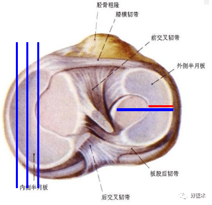 半月板详细解剖及损伤的详细讲解 韧带