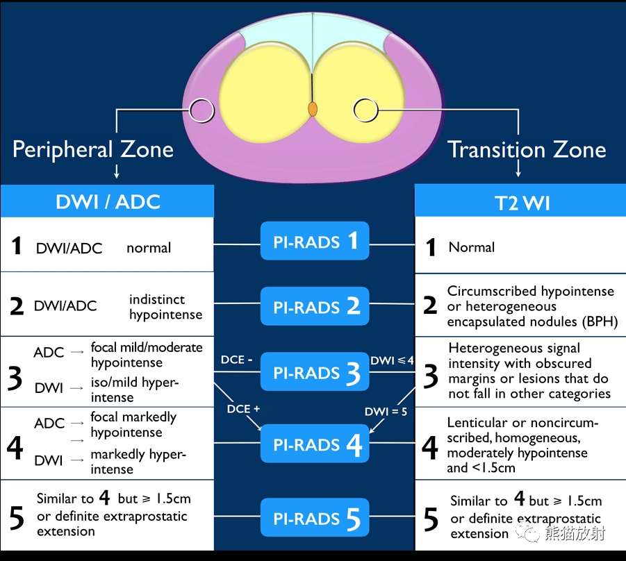 PI-RADS 前列腺影像报告和数据系统_诊断