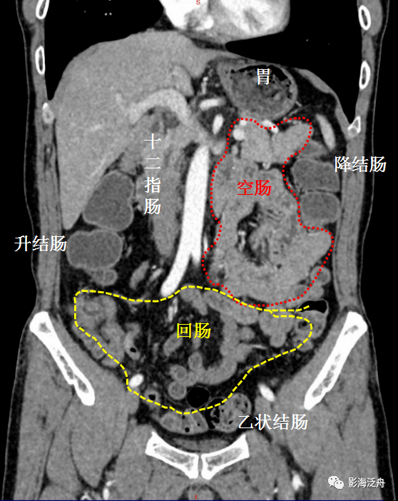 胆道系统ct解剖图图片