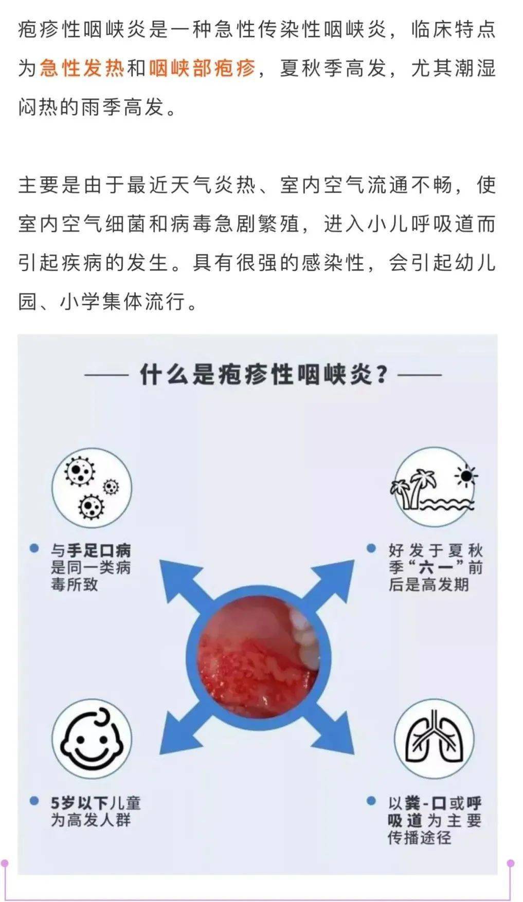 高传染性的疱疹性咽峡炎来了家长注意