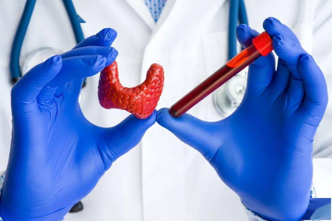 甲状腺肿大,是不是得了桥本甲状腺炎?——中医药防治甲状腺疾病系列科普之三