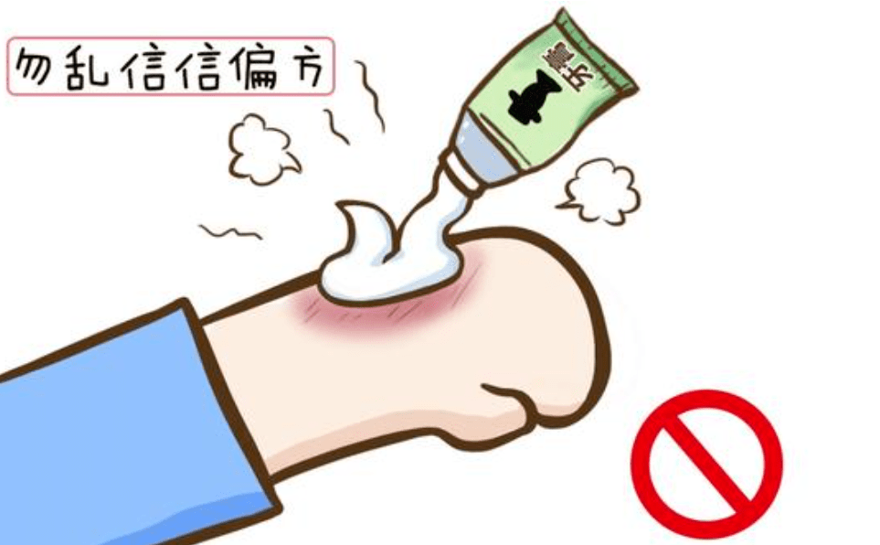 夏天是孩子易烧烫伤的高发期,家庭应急措施了解一下!