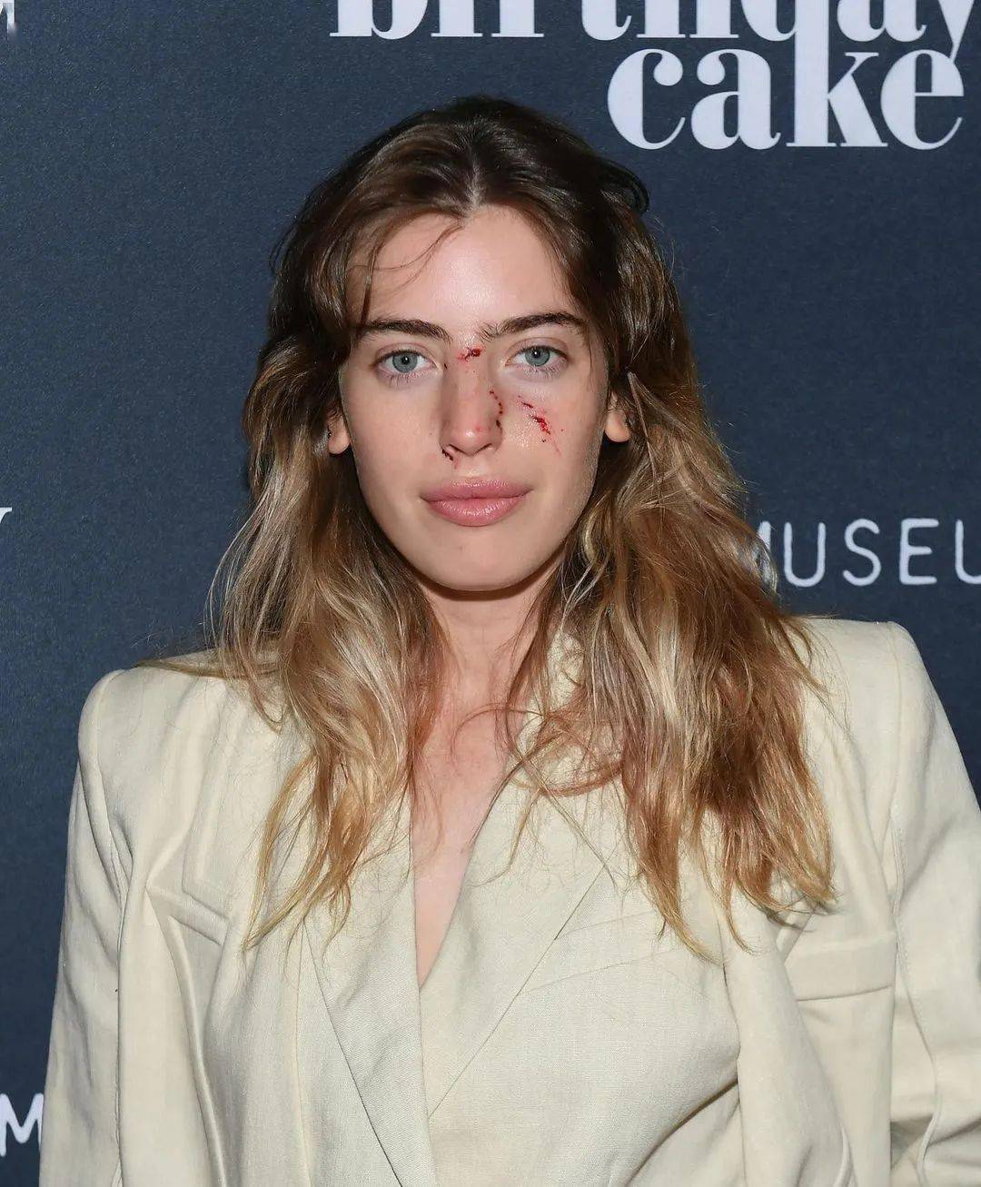 英国女演员走红毯前被狗咬伤脸蛋,坚持走完红毯._mcgregor