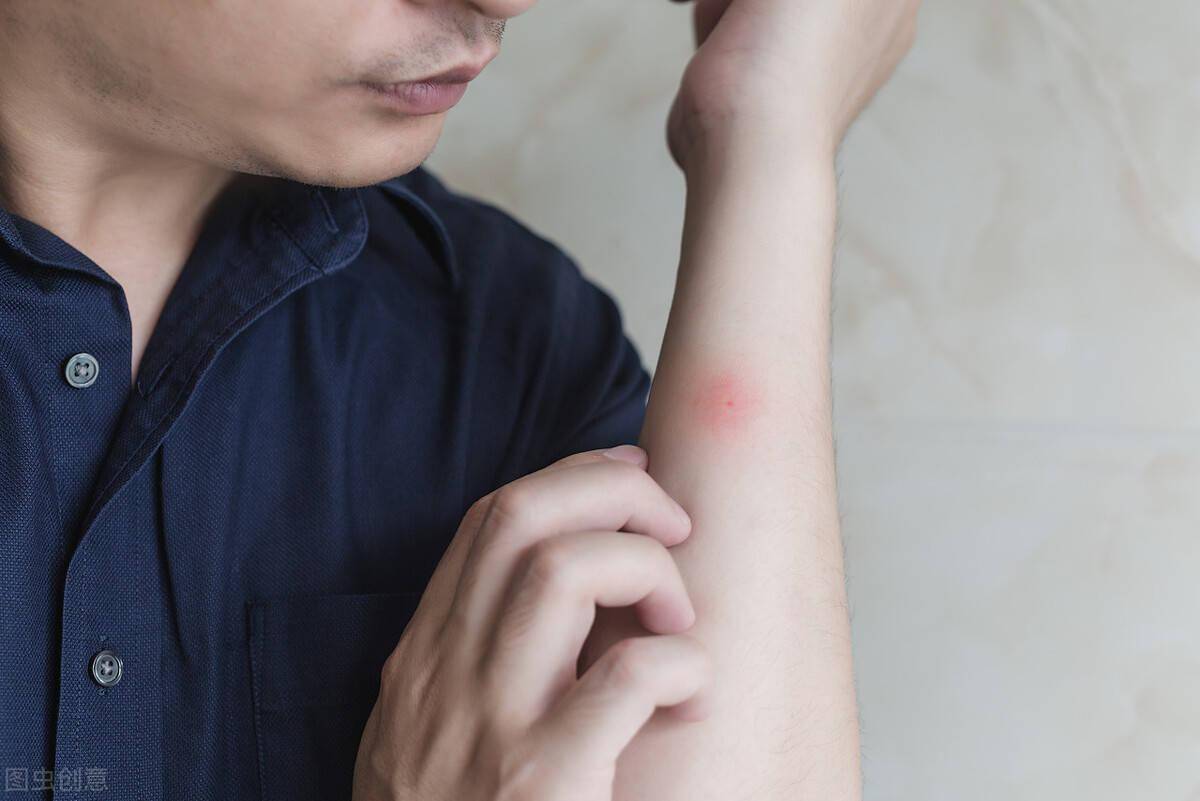 蚊虫叮咬的后果你知道吗