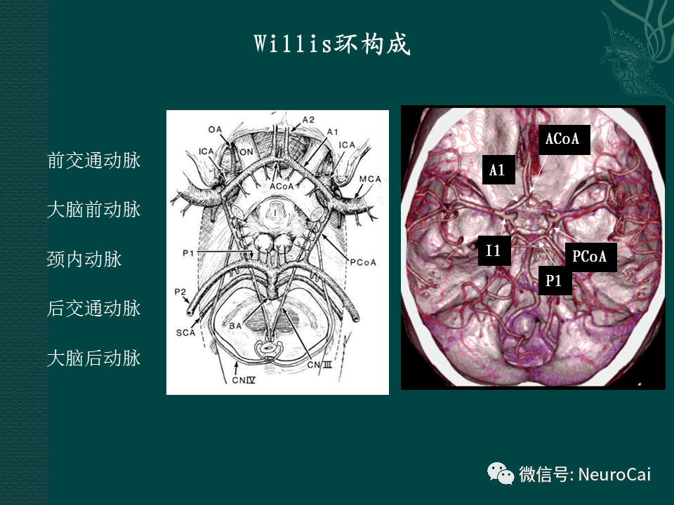 高清圖腦動脈解剖與ct重建