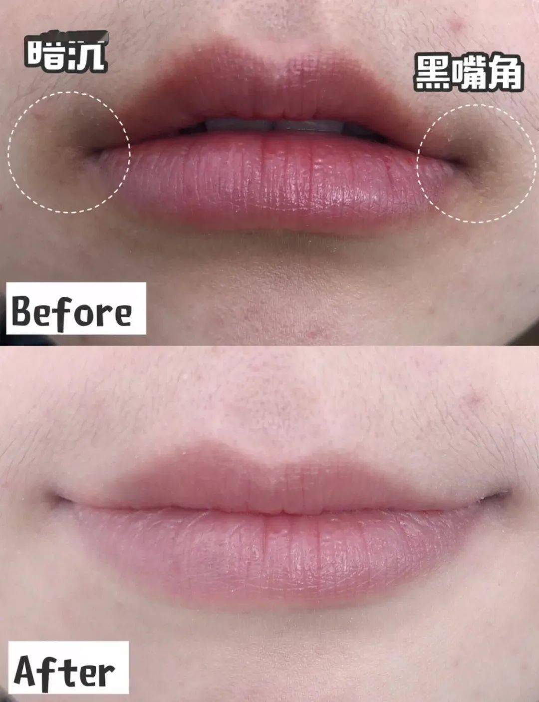 成语唇什么连_成语故事简笔画(5)