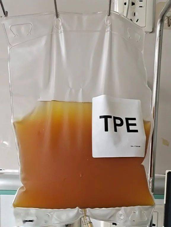 血红蛋白及乳酸脱氢酶变化趋势曲线这是市中心医院血液内科一病区首次