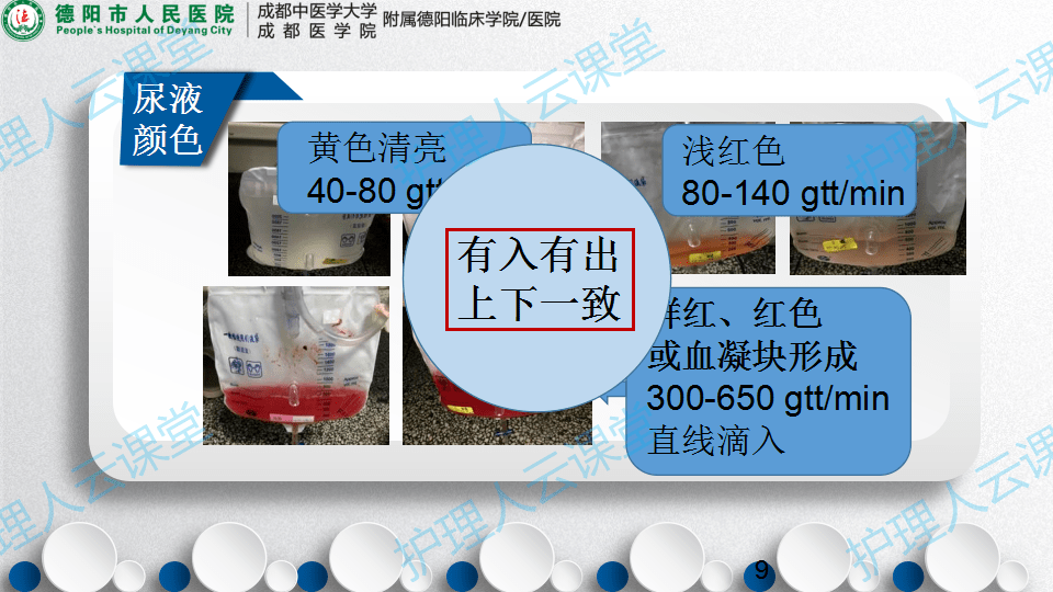 密闭式三腔尿管膀胱冲洗术