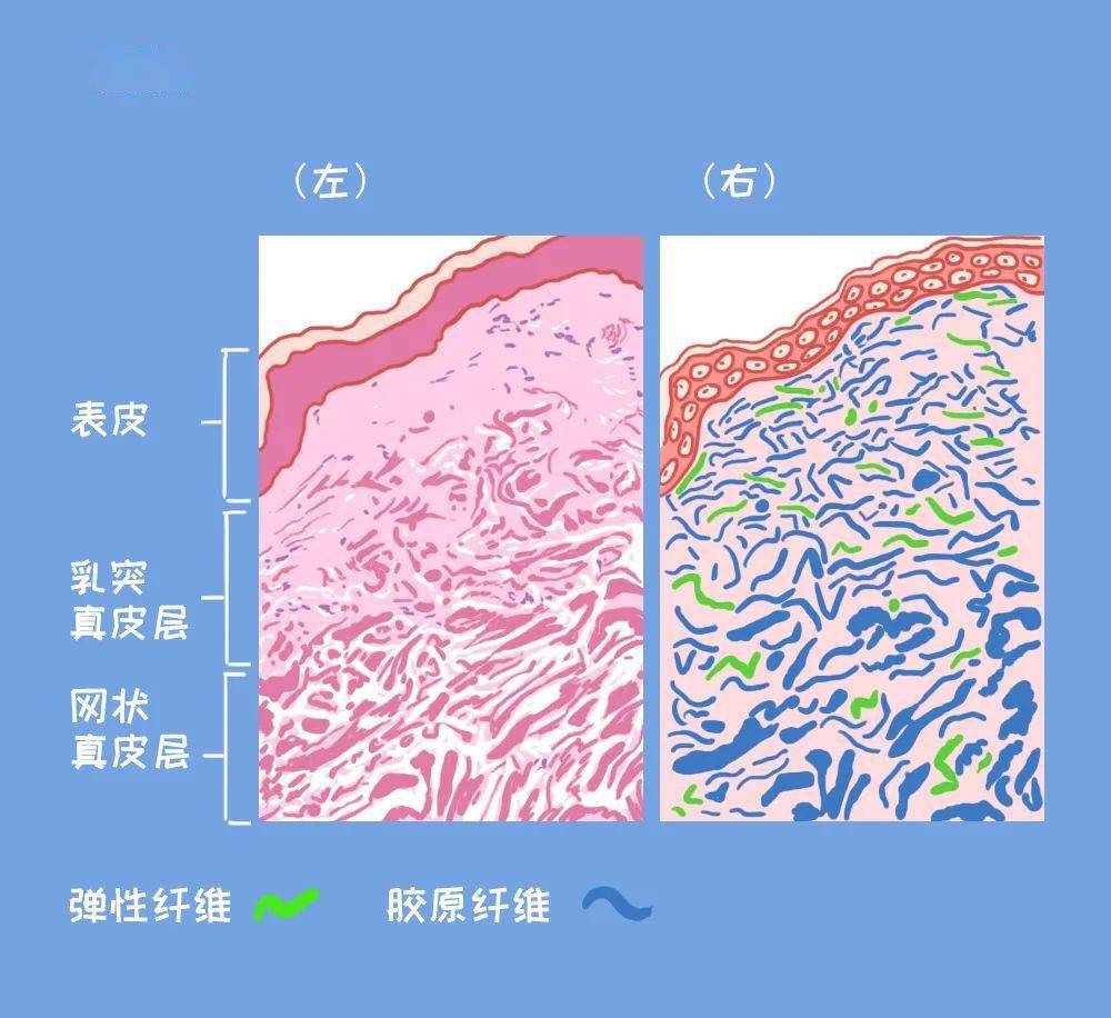 皮肤组织的切片和结构示意图左和右分别是膨胀纹更容易形成会导致皮肤