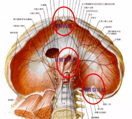 膈肌裂孔位置图图片