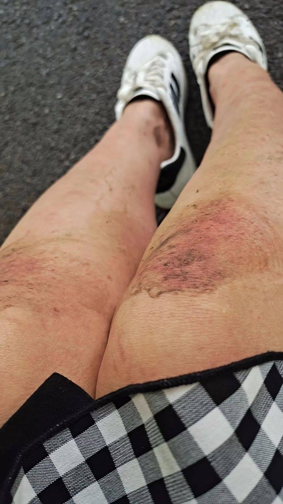 医者仁心!保定女医生跪地心肺复苏半小时,膝盖肿了仍不放弃