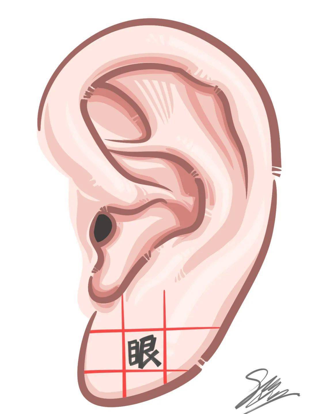 麦粒肿是什么呀?