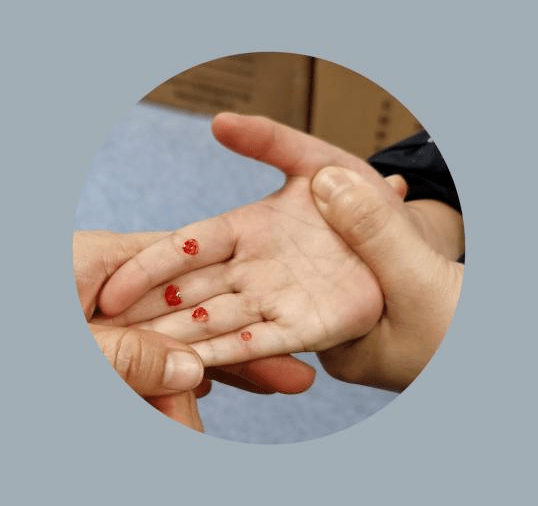 宝宝厌食怎么办市一院中医科有妙招