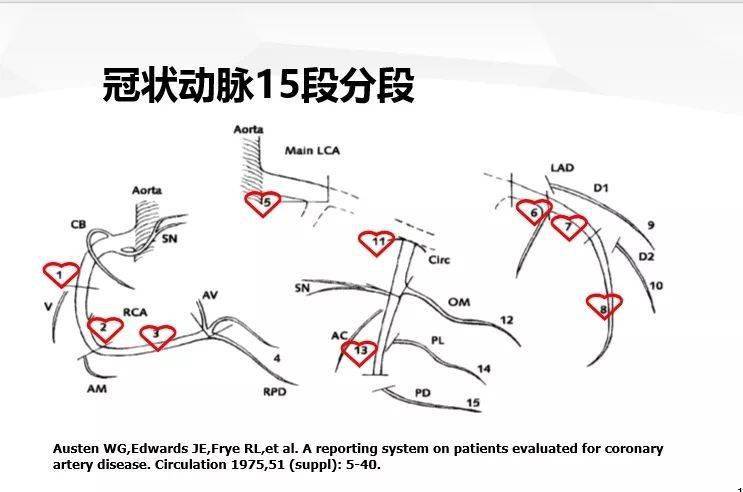 心尖搏动范围图片