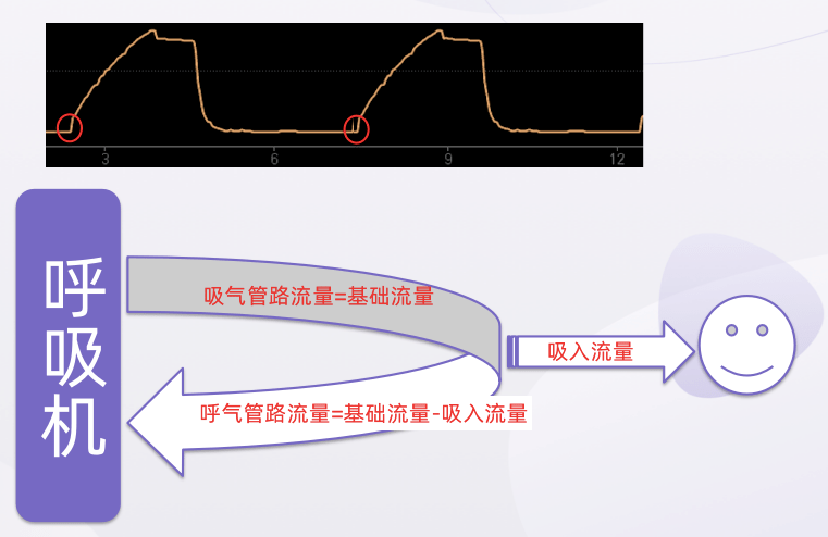 流量觸發(flow trigger)原理是呼吸機監測 y 形管流量來觸發呼吸機