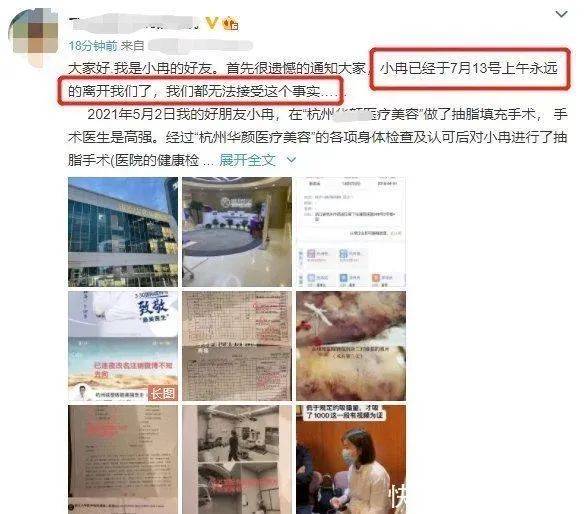 美容|别轻易尝试！“网红”抽脂感染去世，医生提醒→