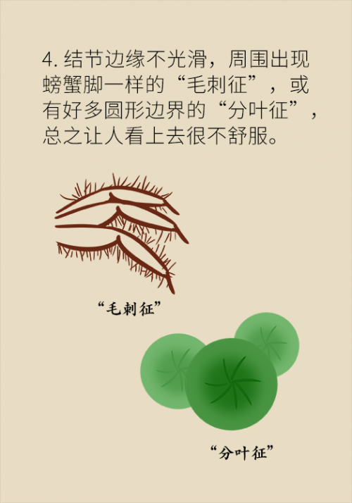 肺部|肺部有6毫米结节用开刀吗？请注意这些关键词
