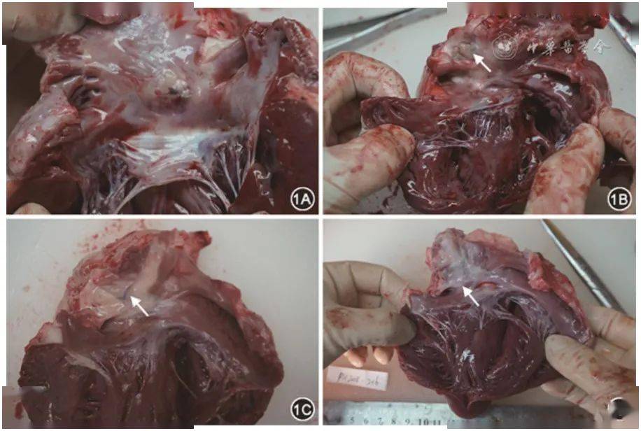 李彬新型国产房间隔外科生物补片临床前在体评价研究