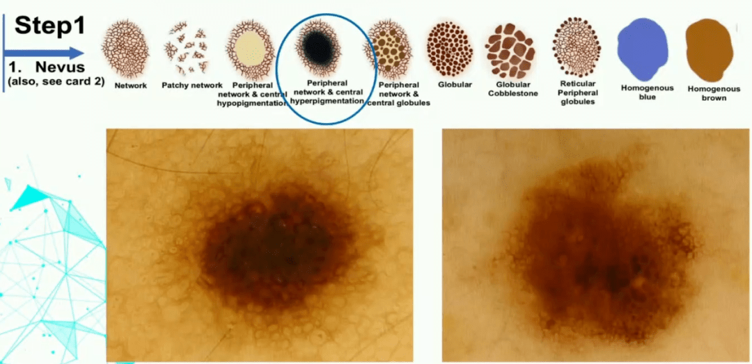 色素沉着图 52edfab1bd7046c5b7bdaf0802b4c6ac.png