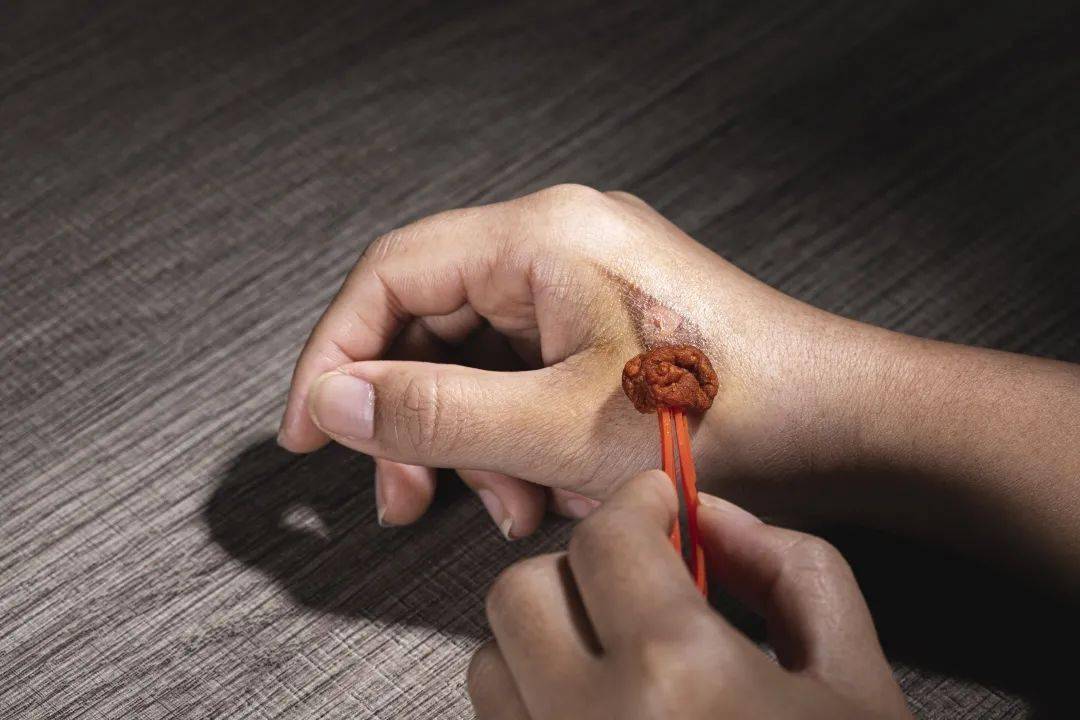 进行|在检验科窗口遇到这5类患者,请务必留个心眼!