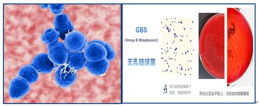 不容忽视的孕期检测项目---b族链球菌_宝宝