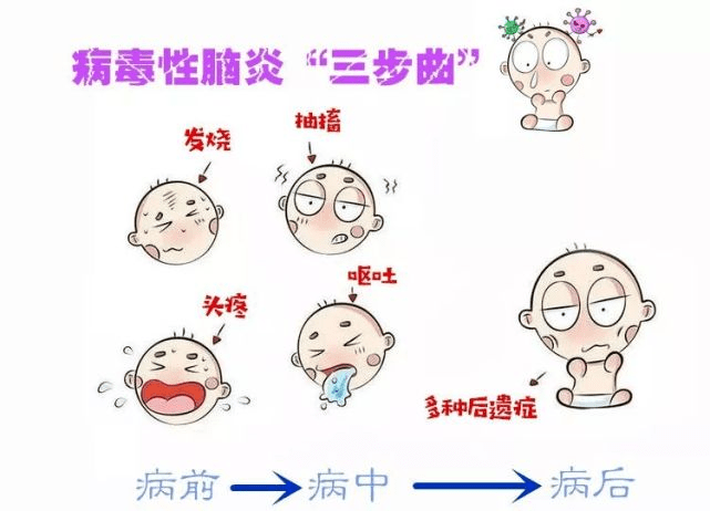 医警联动救在身边丨救治重症单纯疱疹病毒性脑炎患者