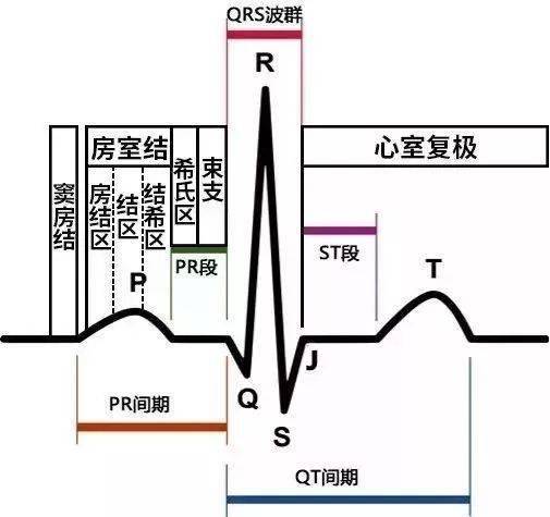 图1 正常的心电图波形