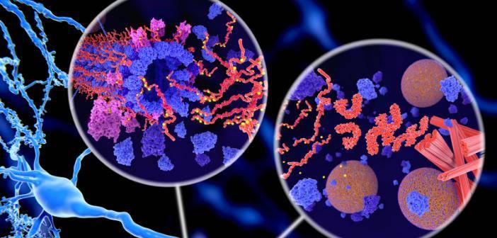 关键作用|酗酒会加速老年痴呆症的发生，并加重症状