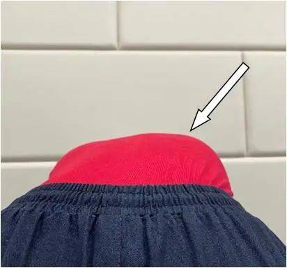 角度|简单辨别脊柱侧弯，避免孩子走“弯”路！