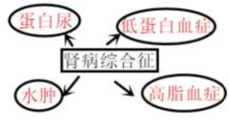 综合征|儿童双眼浮肿、小便量少莫大意,警惕“肾病综合征”