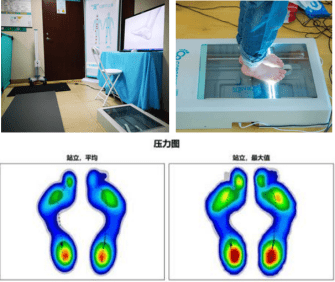 身体状况|全民健身日：医学专家教你科学跑步，不同足弓选择跑鞋有讲究