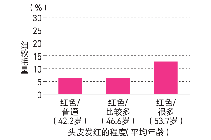 假发|周洁琼拆下5个假发片，保持头皮健康是美发的关键！