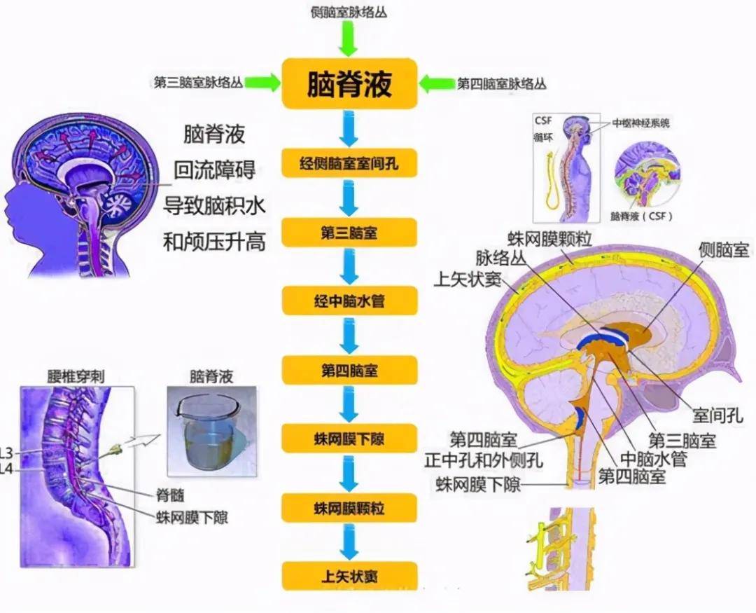 颅内出血后,纤维会出现异常的增生,这时就可能影响到脑脊液的吸收,当