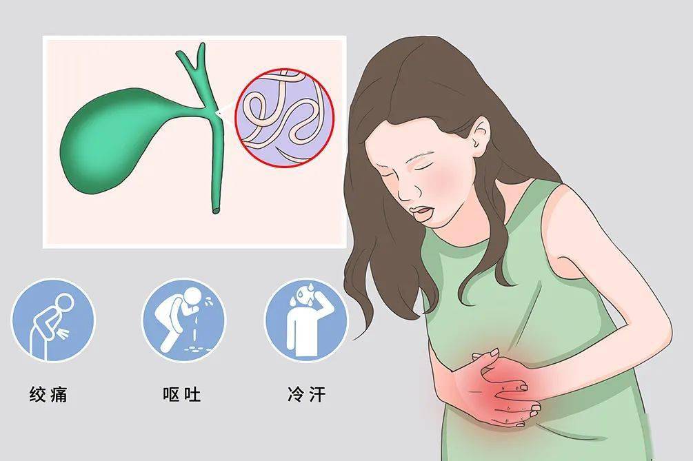 胆道蛔虫病4 神经系统的症状:神情淡漠,嗜睡,神志不清,昏迷5
