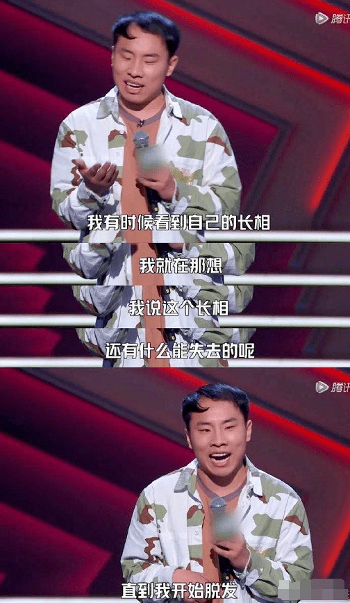 洗头|脱发，又丑又显老！教你一招，头发浓密，更显年轻好气质